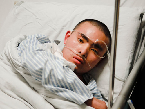 Chen Xilong, a 23-year-old migrant worker from Sichuan province, lies in Guangzhou No 12 People's Hospital suffering the effects of glue poisoning. He had been working in a local handbag factory. Ai Xiuyu / China Daily