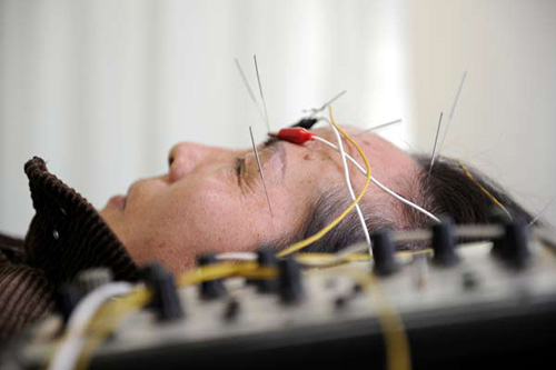 A patient receives acupuncture treatment at a TCM hospital in Yinchuan, Ningxia Hui autonomous region, Oct 22, 2012. [Photo/Xinhua]  