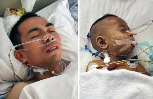 Wan Jinqiang and his son recover after going through an inter-blood-type liver transplant operation at the General Hospital of Armed Police Forces in Beijing on Nov 12, 2012. The 15-hour operation that finished on Tuesday is the first case of a transplant