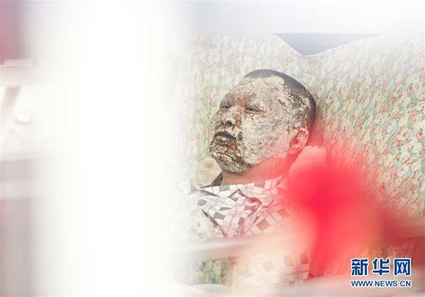 Wu Jun received treatment in the hospital. (Photo/Xinhua)