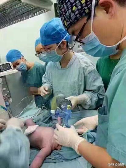 Medical staff members take care of the newborn. (Photo from Sina Weibo)