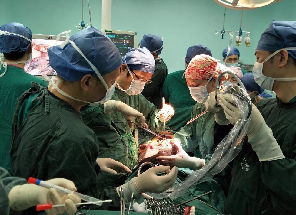 A lung transplant surgery is performed at Wuhan University Peoples Hospital after a 12-hour delivery covering 1,200 kilometers. (Photo provided to chinadaily.com.cn)