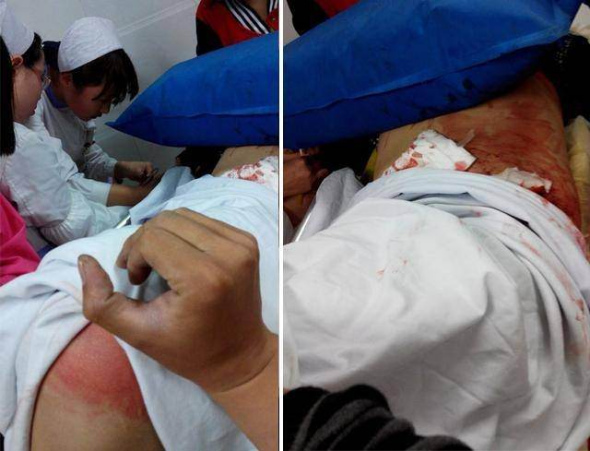 Students injured at hospital. [Photo: Cnwest.com]