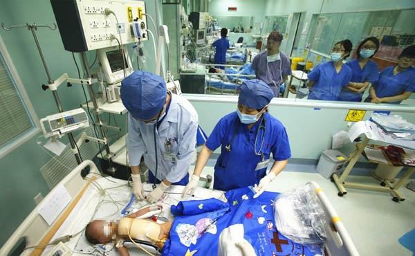 Conjoined twins separated in Shanghai