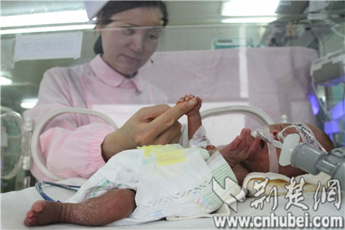 A medical staffer using a finger touches the little hand of a premature baby boy in a hospital of Wuhan who was delivered nine weeks early and weighed only 500g at birthon, May 29 2014. Thanks to the efforts of medical staff, the baby survives. He is over four months old, weighs about 2400 grams and is getting ready to go home. [Photo: cnhubei.com]